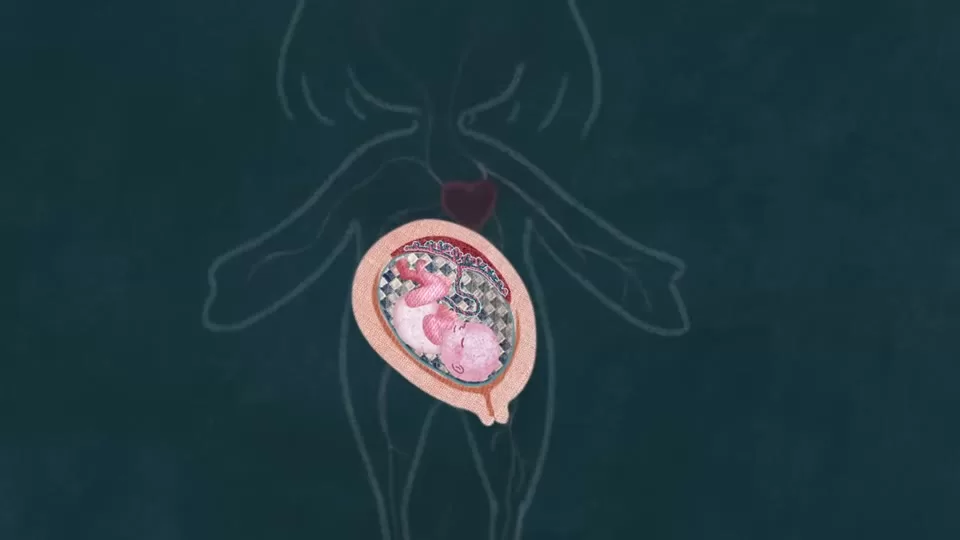 Medical-style illustration showing blood vessels and the placenta during pregnancy
