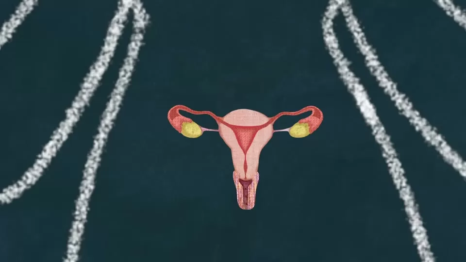 The endometrial lining being shed during menstruation